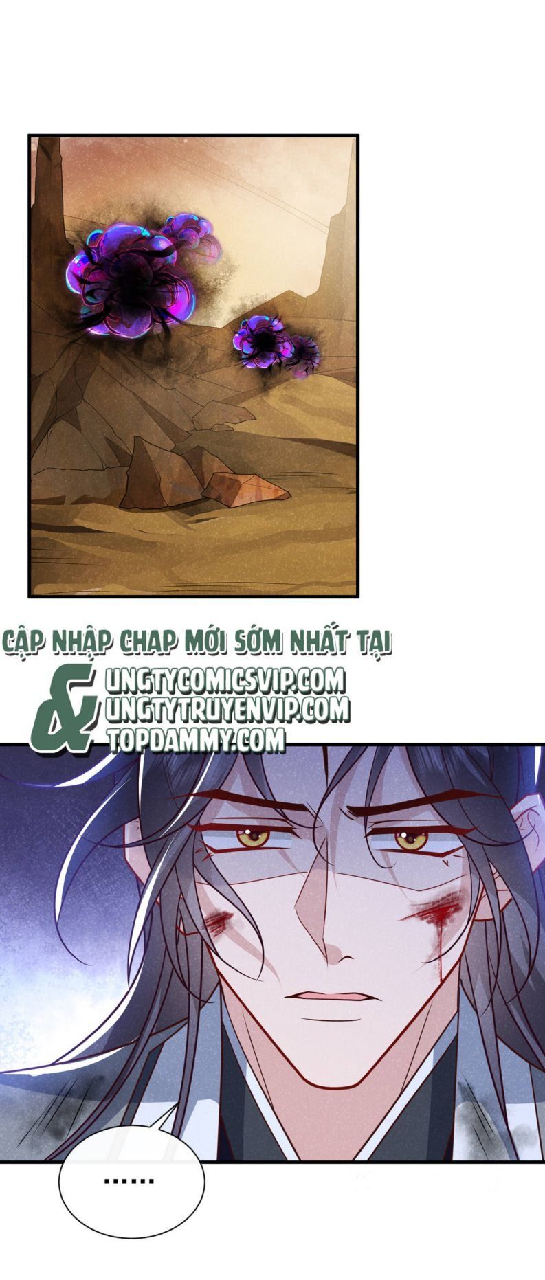 Hôm Nay Lại Lấy Mạng Công Lược Phản Diện Chapter 62 - 5